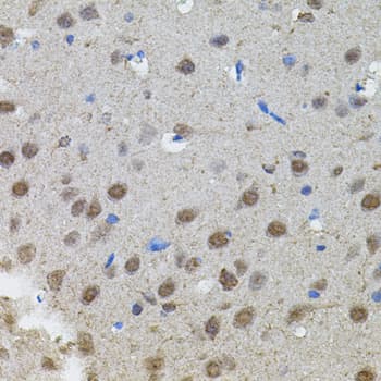 MYCN / N-myc Antibody