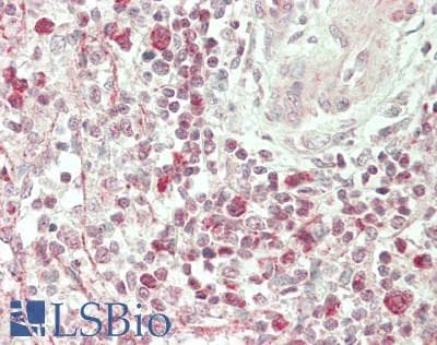 IHC-plus™ SMPD1 / Acid Sphingomyelinase Antibody (Internal)