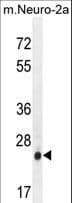 Polyclonal Rabbit anti-Human AP3S1 Antibody (aa1-30, IHC, WB)