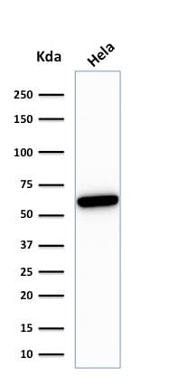 IHC-plus™ HSPD1 / HSP60 Antibody (clone rGROEL/780)