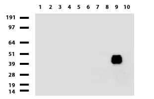 Monoclonal Mouse anti-Human KRT20 / CK20 / Cytokeratin 20 Antibody (clone UMAB172, Carrier-free, IHC, WB)
