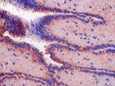 Monoclonal Mouse anti-Human NPBWR1 / GPR7 Antibody (clone 1F9, IHC)