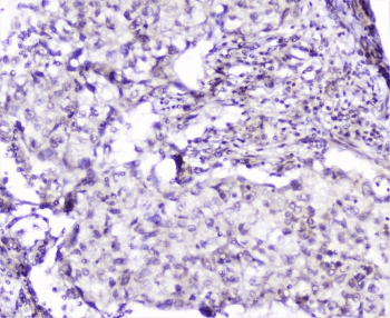 SP1 Antibody