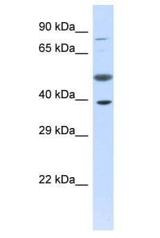 Polyclonal Rabbit anti-Human PRR11 Antibody (aa311-360, WB)