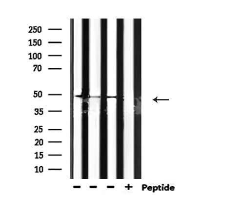 GSK3A / GSK3 Alpha Antibody (phospho-Tyr279,pTyr216)
