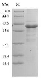 Human PPIAL4A Protein (Recombinant 6His-SUMO, N-terminus)