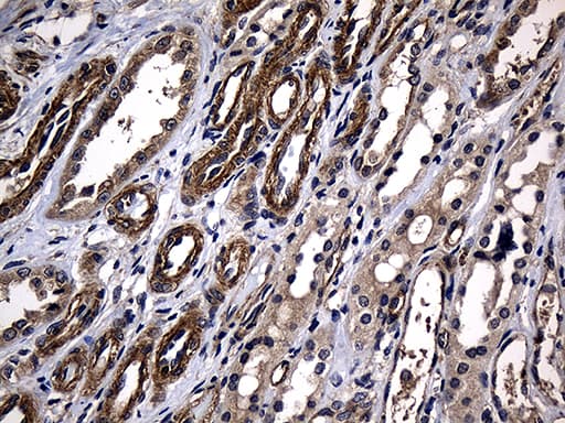 AFAP1 / AFAP Antibody (clone OTI2A3)