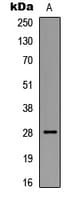 BCL2 / Bcl-2 Antibody (phospho-Ser87)