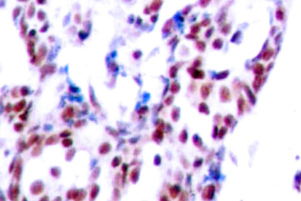 Polyclonal Rabbit anti-Human ATF2 Antibody (Val65/47, IHC, WB)