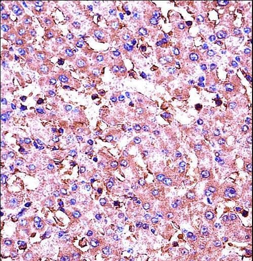 Polyclonal Rabbit anti-Human IGF1 Antibody (aa115-144, IHC, IF, WB)
