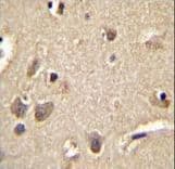 S100A1 / S100-A1 Antibody (aa45-75)