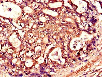 TNFSF11 / RANKL / TRANCE Antibody