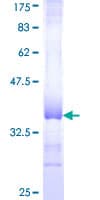 Human COL16A1 Protein (Recombinant GST, N-terminus)