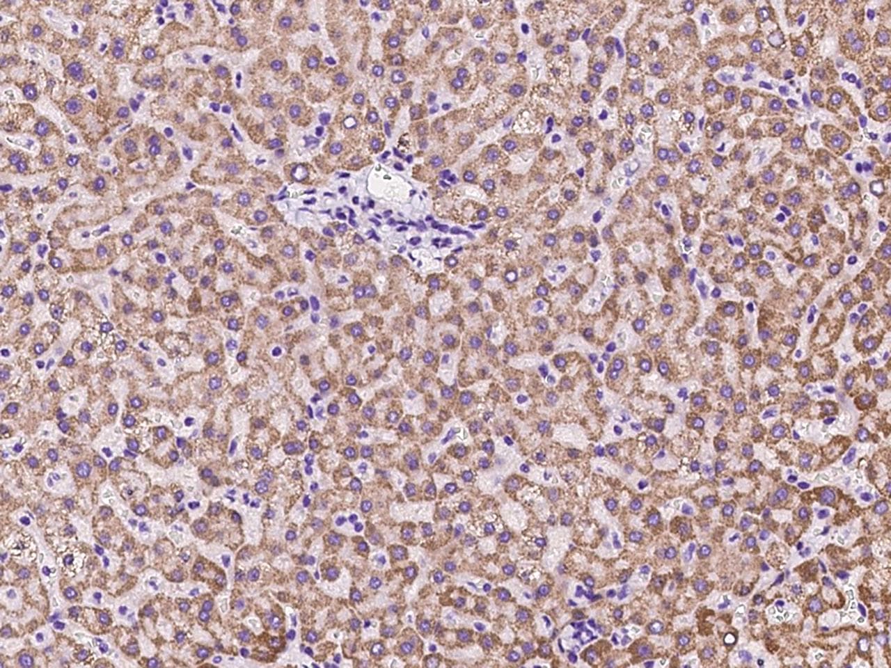 Rhodanese / TST Antibody