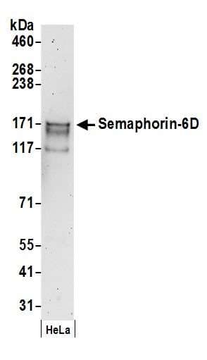 SEMA6D / Semaphorin 6D Antibody (aa1023-1073)