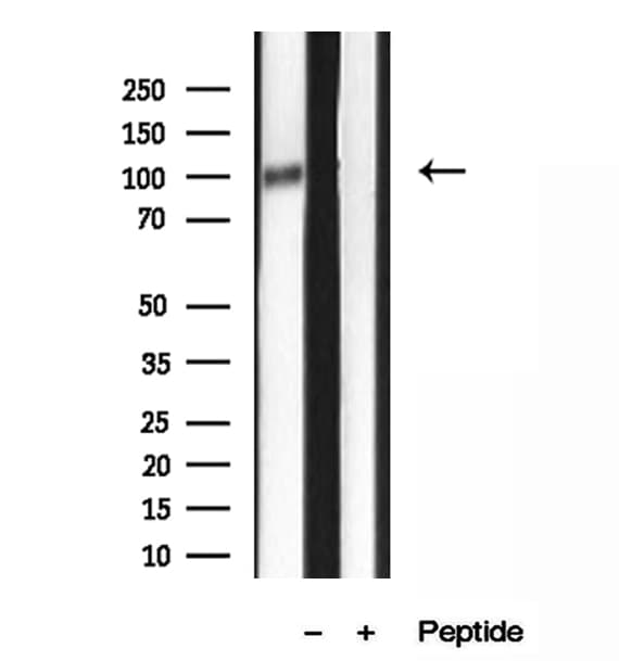 PPP1R15A / GADD34 Antibody