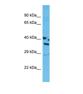 Polyclonal Rabbit anti-Human OR13J1 Antibody (aa225-274, WB)