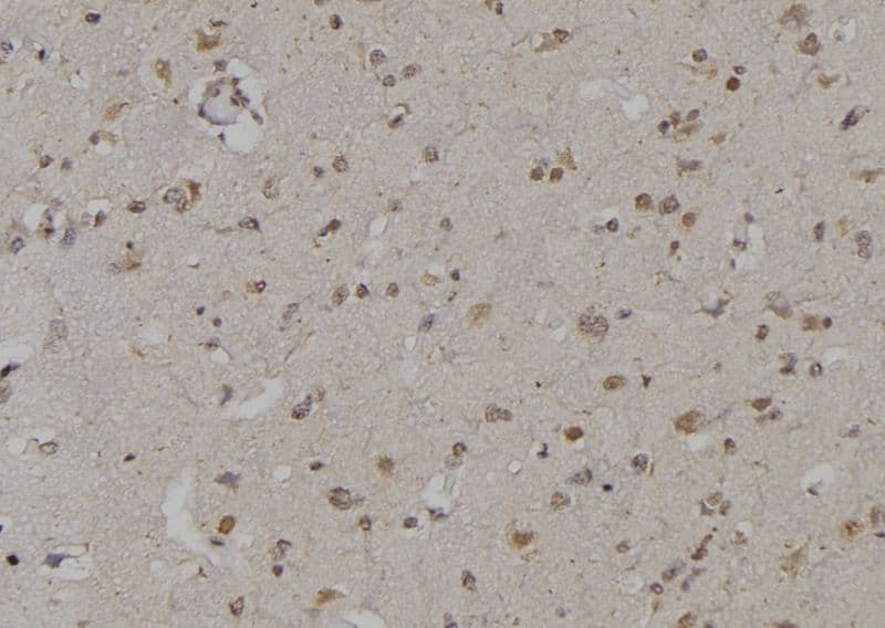 YWHAZ / 14-3-3 Zeta Antibody