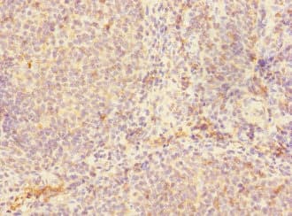 RP105 / CD180 Antibody