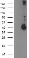 MAPRE2 / EB2 Antibody (clone OTI1D10)