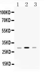 Polyclonal Rabbit anti-Human HLA-DPB1 Antibody (WB)