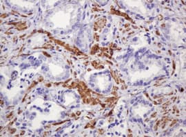 PADI4 / PAD4 Antibody (clone OTI5C10)