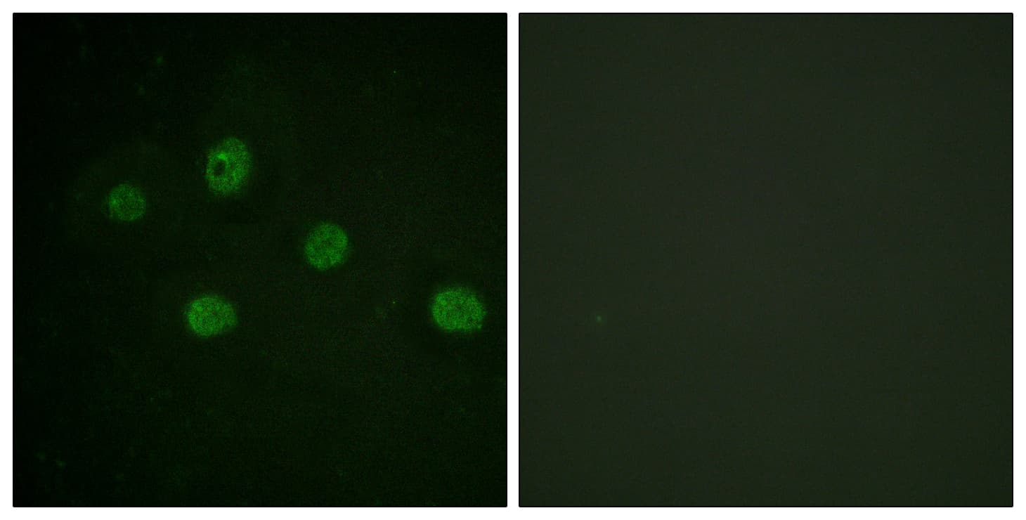 PRKDC / DNA-PKcs Antibody (aa2578-2627)