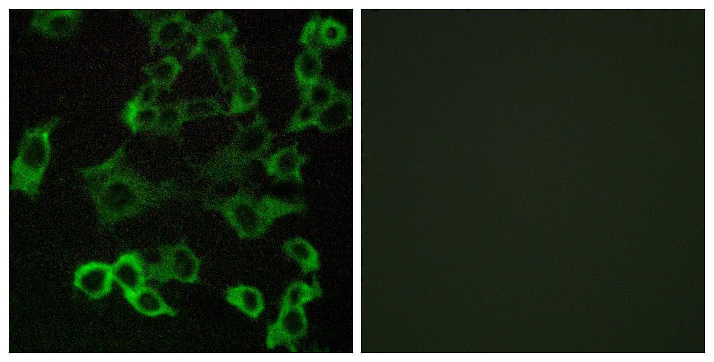 CX3CR1 Antibody