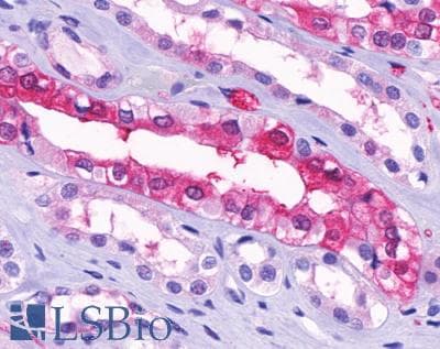 IHC-plus™ Polyclonal Rabbit anti-Human SUCNR1 / GPR91 Antibody (Cytoplasmic Domain, IHC)