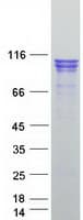 Human CTNNA2 / Alpha-2 Catenin Protein (Recombinant Myc-DDK (Flag))