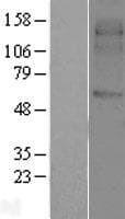 SVOP Protein (Over-Expression Lysate Myc-DDK (Flag))