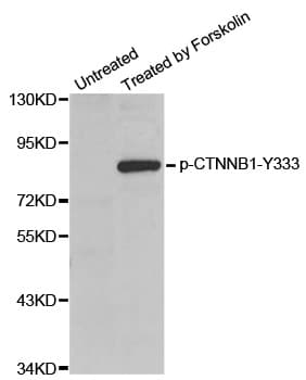 CTNNB1 / Beta Catenin Antibody (phospho-Tyr333)
