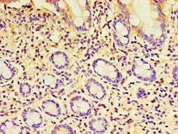 Polyclonal Rabbit anti-Human EXOC2 / SEC5 Antibody (aa1-220, IHC)