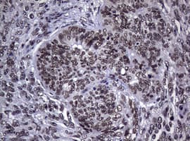NBN / Nibrin Antibody (clone OTI9H2)