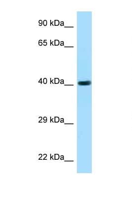 FUT3 Antibody (C-Terminus)