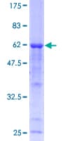 Human CAPN3 / Calpain 3 Protein (Recombinant GST)
