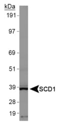 SCD1 / SCD Antibody (aa50-100, DY650)