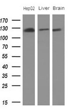 ANPEP / CD13 Antibody (aa668-967, clone OTI3F8)