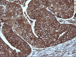 MAP2K1 / MKK1 / MEK1 Antibody (clone OTI2B2, Carrier-free)