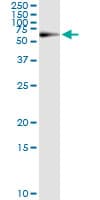 PGM1 / Phosphoglucomutase 1 Antibody (clone 3B8-H4)