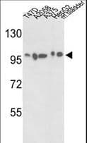 ACTN4 Antibody (aa785-813)