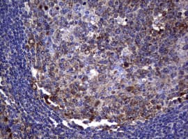 NME1 / NM23 Antibody (clone OTI7E5)