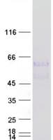 Human LIPG / Endothelial Lipase Protein (Recombinant Myc-DDK (Flag))