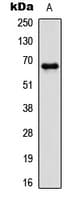 PAK1 Antibody (phospho-Thr212)