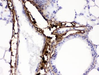 Polyclonal Rabbit anti-Mouse COL1A1 / Collagen I Alpha 1 Antibody (IHC, WB)