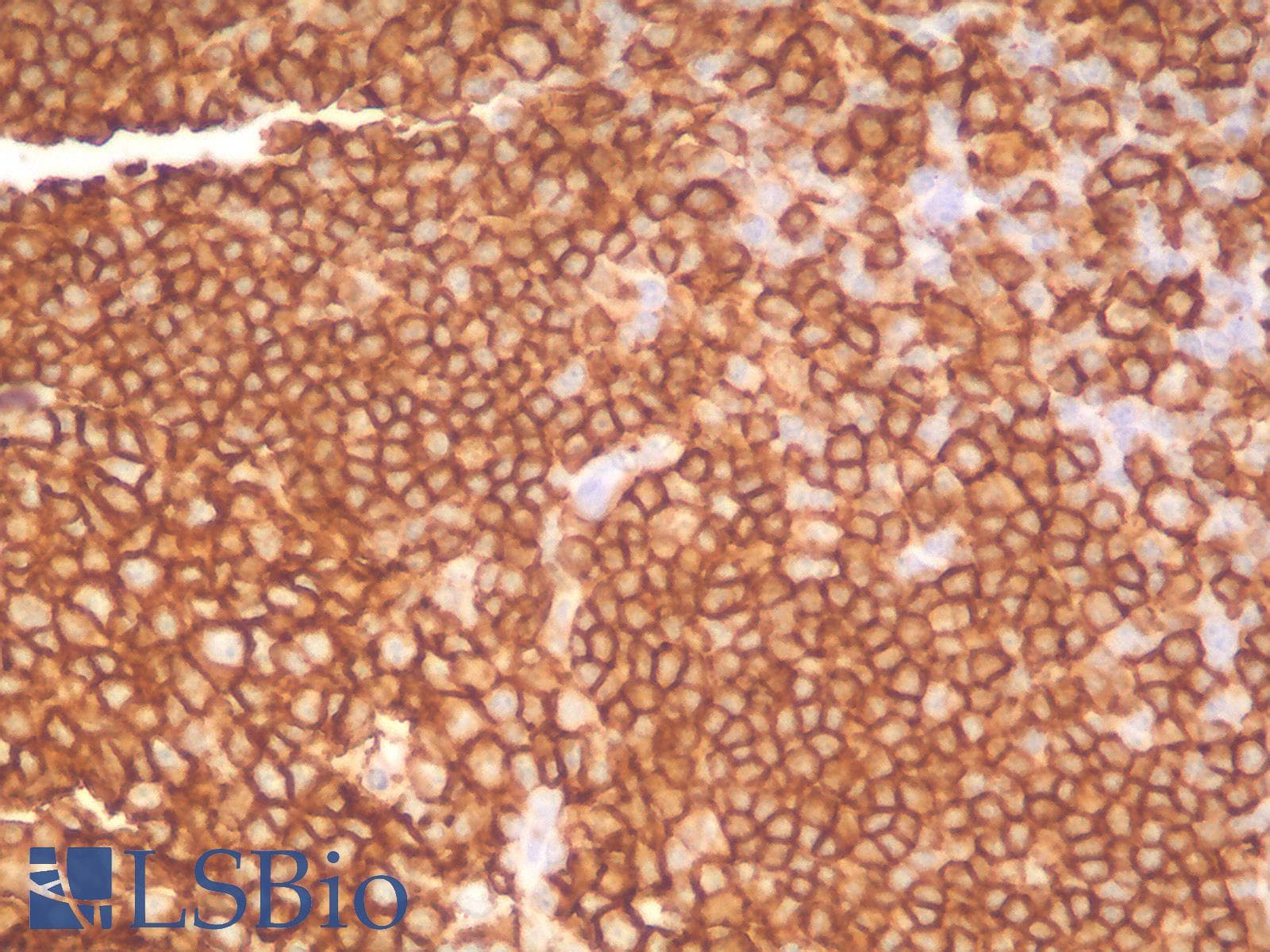 PathPlus™ CD20 Antibody (clone IGEL/1497R)