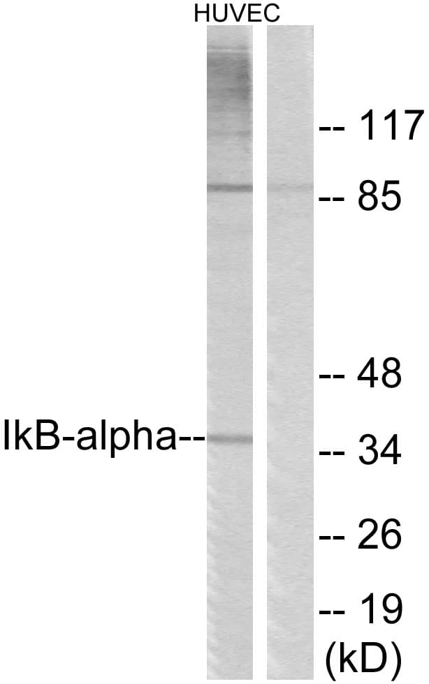 IHC-plus™ NFKBIA / IKB Alpha / IKBA Antibody (aa9-58)