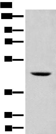 SHPK / CARKL Antibody