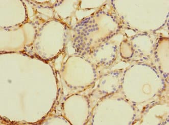 TTC12 Antibody