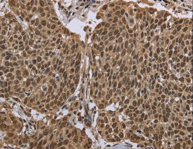 PPAT Antibody